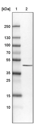 Lane 1: Marker [kDa]_br/_Lane 2: Human cell line U-251 MG