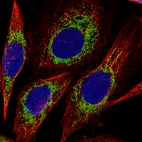 Immunofluorescence staining of PC-3 cells using the Anti-CS monoclonal antibody, showing specific staining in mitochondria in green. Microtubule- and nuclear probes are visualized in red and blue, respectively (where available).