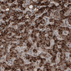 Immunohistochemical staining of human liver shows strong granular cytoplasmic positivity in hepatocytes.