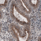Immunohistochemical staining of human endometrium shows granular cytoplasmic immunoreactivity in glandular cells.