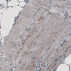 Anti-ACAA1 Antibody