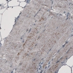Immunohistochemical staining of human skeletal muscle shows granular cytoplasmic positivity.