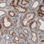 Immunohistochemical staining of human kidney shows granular cytoplasmic immunoreactivity in renal tubules.