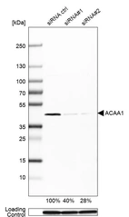 Western blot analysis in U-251MG cells transfected with control siRNA, target specific siRNA probe #1 and #2, using Anti-ACAA1 antibody. Remaining relative intensity is presented. Loading control: Anti-PPIB.