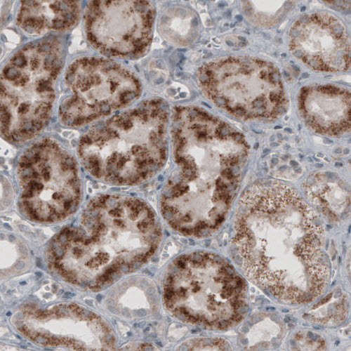 Anti-ACAA1 Antibody