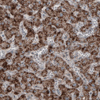 Anti-ACAA1 Antibody