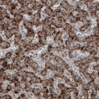 Immunohistochemical staining of human liver shows strong granular cytoplasmic positivity in hepatocytes.