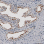 Immunohistochemical staining of human prostate shows granular cytoplasmic immunoreactivity in glandular cells.