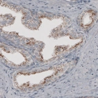 Immunohistochemical staining of human prostate shows granular cytoplasmic immunoreactivity in glandular cells.