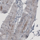 Immunohistochemical staining of human skeletal muscle shows granular cytoplasmic positivity.