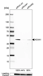 Western blot analysis in U-251MG cells transfected with control siRNA, target specific siRNA probe #1 and #2, using Anti-ACAA1 antibody. Remaining relative intensity is presented. Loading control: Anti-PPIB.