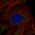 Anti-ACAA1 Antibody