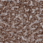 Anti-ACAA1 Antibody