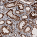 Immunohistochemical staining of human kidney shows granular cytoplasmic immunoreactivity in renal tubules.