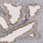 Anti-ACAA1 Antibody