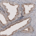 Immunohistochemical staining of human prostate shows granular cytoplasmic immunoreactivity in glandular cells.