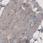 Immunohistochemical staining of human skeletal muscle shows granular cytoplasmic immunoreactivity.