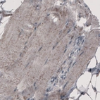 Immunohistochemical staining of human skeletal muscle shows granular cytoplasmic immunoreactivity.