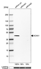 Western blot analysis in U-251MG cells transfected with control siRNA, target specific siRNA probe #1 and #2, using Anti-ACAA1 antibody. Remaining relative intensity is presented. Loading control: Anti-PPIB.