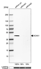 Western blot analysis in U-251MG cells transfected with control siRNA, target specific siRNA probe #1 and #2, using Anti-ACAA1 antibody. Remaining relative intensity is presented. Loading control: Anti-PPIB.