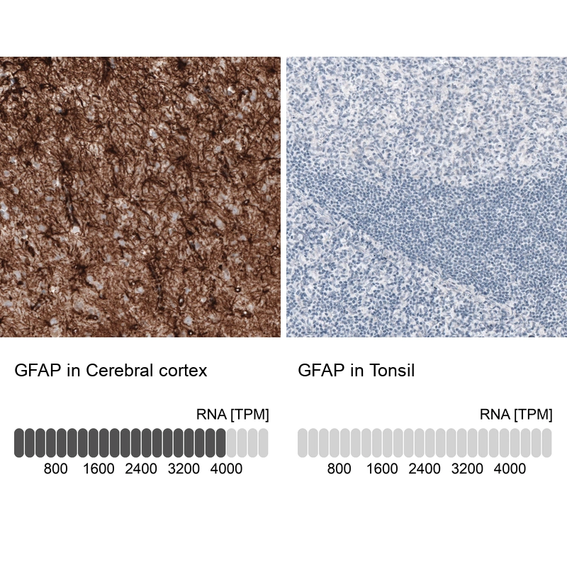 Mouse Monoclonal Anti-GFAP Antibody - Buy for research - Highly ...