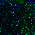 Immunofluorescence staining of rat brain shows strong positivity in astrocytes in the hippocampus.
