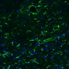 Immunofluorescence staining of mouse brain shows strong positivity in astrocytes in the brainstem.