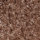 Immunohistochemical staining of human cerebral cortex shows strong cytoplasmic positivity in astrocytes.