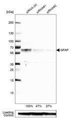 Western blot analysis in U-87MG ATCC cells transfected with control siRNA, target specific siRNA probe #1 and #2, using Anti-GFAP antibody. Remaining relative intensity is presented. Loading control: Anti-GAPDH.