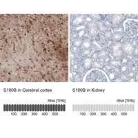 Anti-S100B Antibody