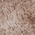 Immunohistochemical staining of human cerebral cortex shows moderate nuclear positivity in astrocytes.