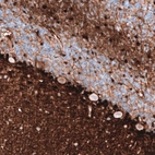 Immunohistochemical staining of human cerebellum shows strong nuclear positivity in glial cells.