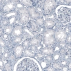 Immunohistochemical staining of human kidney shows no nuclear positivity as expected.