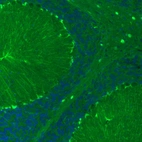 Immunofluorescence staining of mouse brain shows moderate positivity in the cerebellum.
