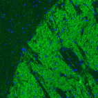 Immunofluorescence staining of mouse basal forebrain shows positivity in GABAergic fibers in the globus pallidus.