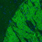 Immunofluorescence staining of mouse basal forebrain shows positivity in GABAergic fibers in the globus pallidus.