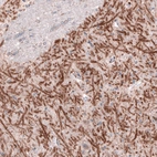 Immunohistochemical staining of human midbrain shows positivity in GABAergic fibers in substantia nigra, pars reticulata.