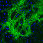 Anti-GAD2 Antibody