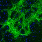 Immunofluorescence staining of rat basal forebrain shows strong positivity in GABAergic neural fibers in the globus pallidus.