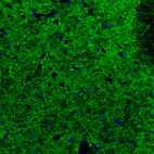 Anti-GAD2 Antibody