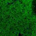 Immunofluorescence staining of rat basal forebrain shows moderate to strong positivity in GABAergic neural fibers.