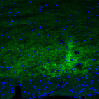 Immunofluorescence staining of mouse midbrain shows moderate positivity in GABAergic neural fibers in the substantia nigra.