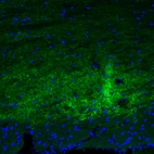 Immunofluorescence staining of mouse midbrain shows moderate positivity in GABAergic neural fibers in the substantia nigra.