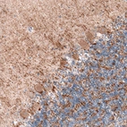 Immunohistochemical staining of human cerebellum shows moderate to strong positivity in GABAergic neuronal processes.
