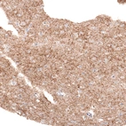 Immunohistochemical staining of human cerebral cortex shows moderate to strong positivity in GABAergic neuronal processes.