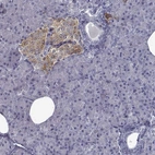 Immunohistochemical staining of human pancreas shows moderate cytoplasmic positivity in endocrine glandular cells.