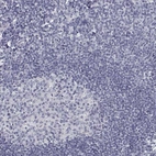 Immunohistochemical staining of human tonsil shows no positivity in non-germinal center cells as expected.