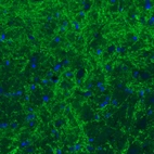 Immunohistochemical staining of rat basal forebrain shows moderate immunoreactivity in GABAergic fibers.