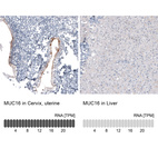 Anti-MUC16 Antibody