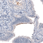 Anti-MUC16 Antibody